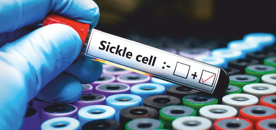 Fortis Gurugram Achieves Global-Standard Success in Curing Children with Sickle Cell Disease