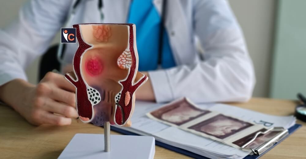 Choosing the Right Fistula Treatment Specialist for Your Needs